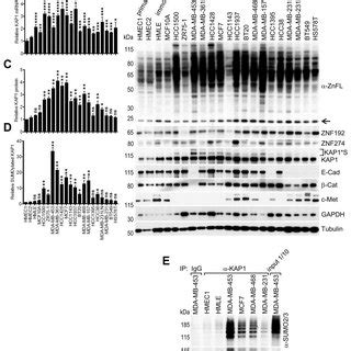 KAP1 MRNA Protein And SUMOylation Are Up Regulated In Breast Cancer