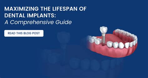 Dental Implants What Is The Lifespan