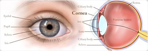 What is Cornea of Eye | Cornea Specialist Dr.Kareeshma Wadia | keratitis