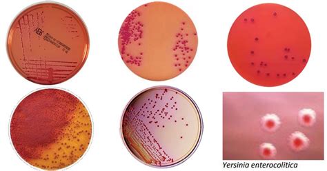 Yersinia Selective Agar Composition Principle Results Uses