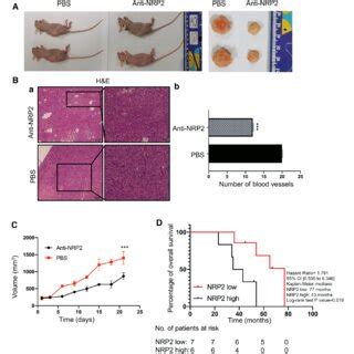 Nrp Expression Is Positively Correlated With Pnet Vascularity A