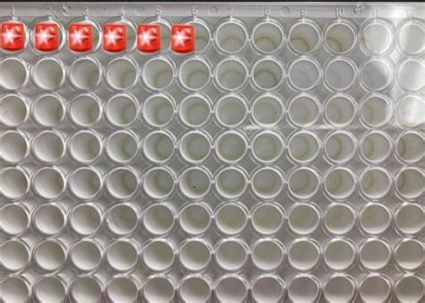 Luciferase Reporter Assay - Protocol - The Science Notes