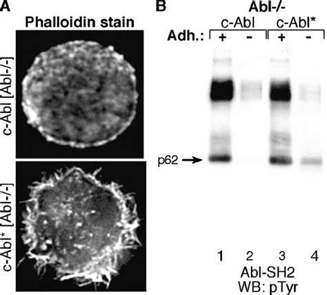 Stable Expression Of Activated C Abl C Abl In Nonadherent