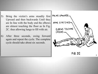 Artificial respiration method | PPT