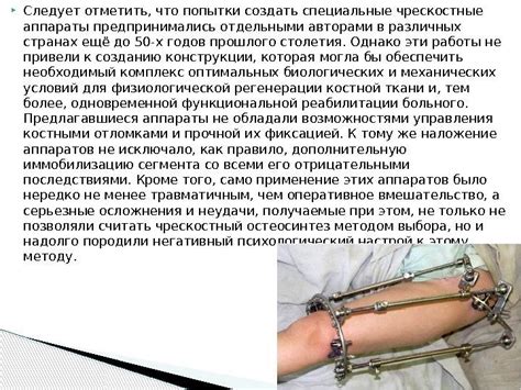 Аппарат Илизарова — медицинский аппарат, предназначенный