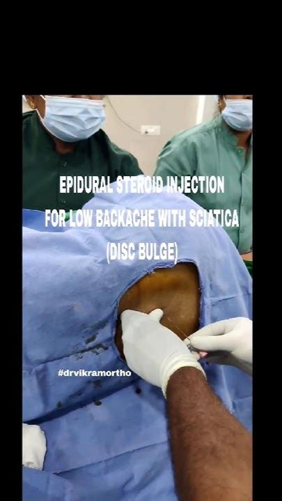 Epidural Steroid Injection For Sciatica 💉 Youtubeshorts Viral Youtube