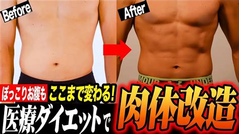 【肉体改造】1ヶ月でぽっこりお腹がここまで変わる！医療ダイエットでアスリート体型に！ Youtube