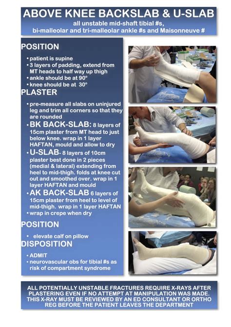 Cme 22514 Plaster Tips And Guides Charlies Ed