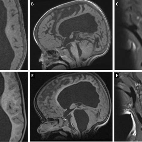 Preoperative studies.A–C: MRI performed during follow-up after... | Download Scientific Diagram