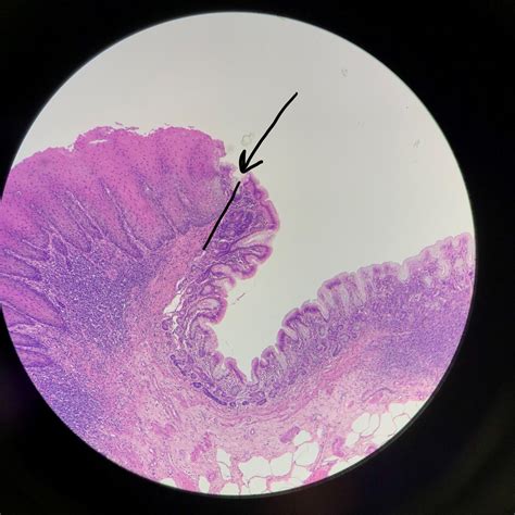 Stomach/Esophagus Junction Slide Diagram | Quizlet