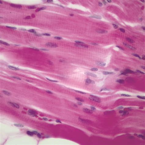 Muscle Skeletal Human Cross Section And Ls Microscope Slide