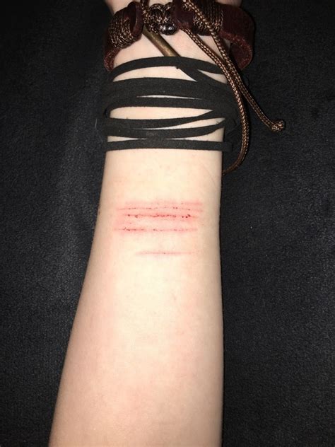 How To Cover Self Harm Cuts On Wrist Quora