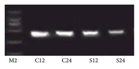 A Bcl 2 And B Bax Rt Pcr Analysis Of The Aortic Endothelium In The