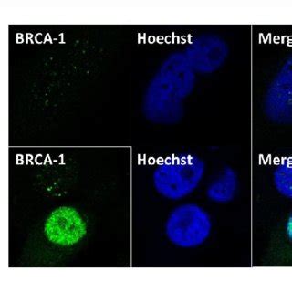 Loss Of Brca Expression In Brca Mutant Seoc Cell Line Uwb Cells