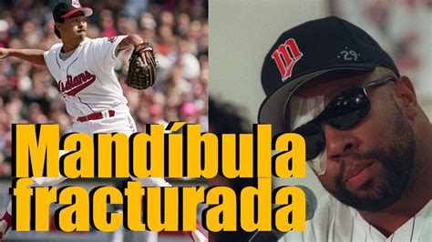 Dennis Mart Nez Quiebra La Mand Bula De Kirby Puckett Youtube