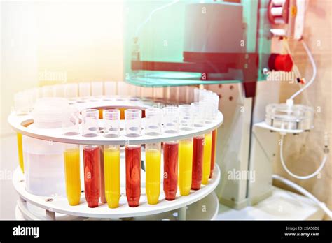 professional laboratory sample processor pump automation  ion