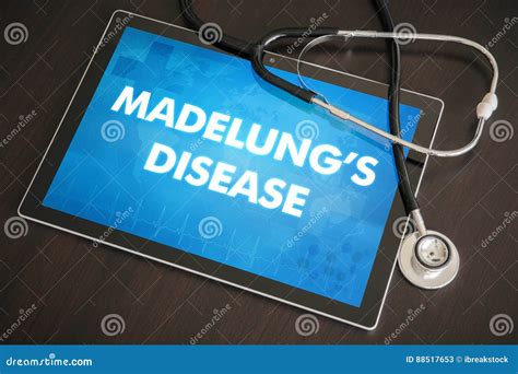 Madelung S Disease (cutaneous Disease) Diagnosis Medical Concept Stock ...