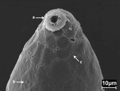 Scanning electron microscope view of egg of A. distincta. Anterior pole ...