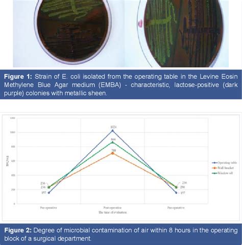 PDF Evaluation Of Microbial Contamination In A Surgical Department Of