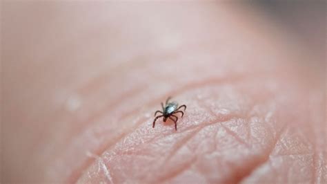 Lyme Hastal Nedir Belirtileri Neler Lyme Hastal Tedavisi Nas L