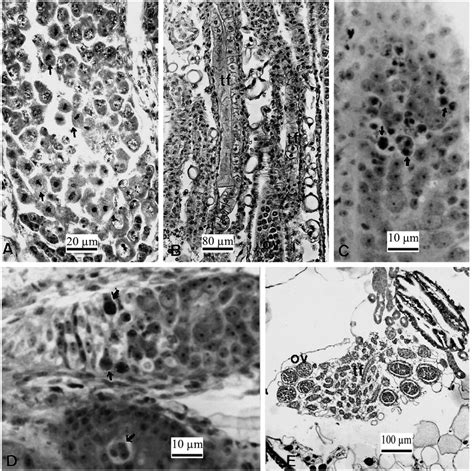 Light Micrographs Showing Differentiation Along An Ovary Of