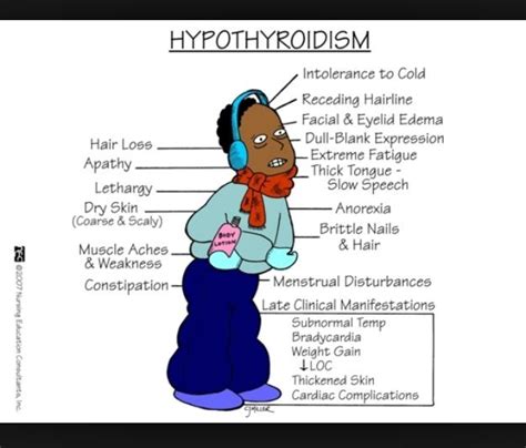 Hypothyroidism Metabolism Med Surg Nursing Nursing Mnemonics