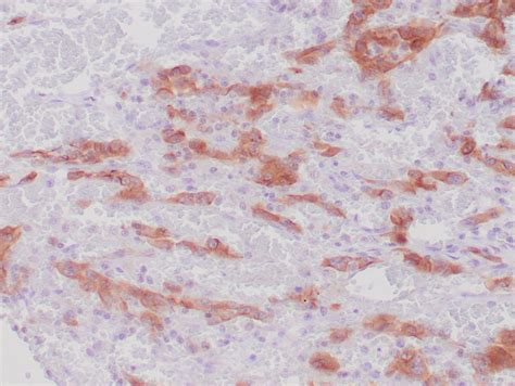 alk  antibody recombinant ivd antibody  ihc zeta corporation