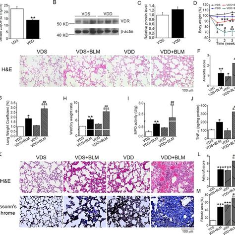 Paricalcitol Attenuates BLM Induced Structural Damage And Lung Fibrosis