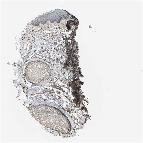 Tissue Expression Of Col A Staining In Skin The Human Protein Atlas