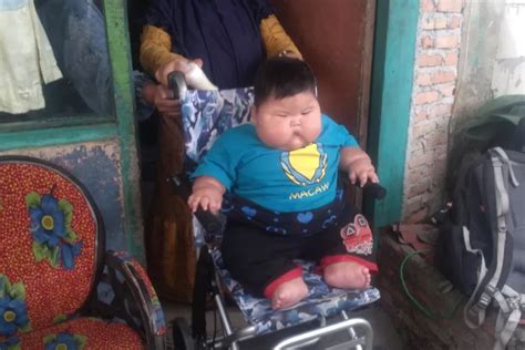 Viral Bayi Bulan Alami Obesitas Berikut Penjelasan Idai Terkait