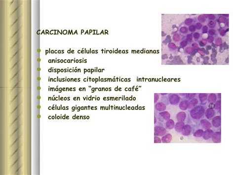 Pdf Citolog A Tiroidea Lesion Folicular Endosuem Org Uy Wp Content