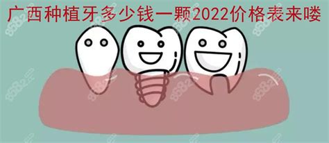 广西种植牙多少钱一颗2024价格表含南宁桂林玉林种牙价格~种植牙 8682整形网