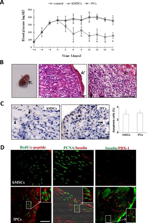 Transplantation Of Ipcs Into Stz Treated Diabetic Nude Mice In