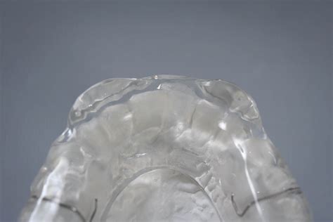 4)Bruxism Splint(Night Guard)4 – STAALAB