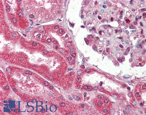 Ihc Plus Collagen I Polyclonal Antibody Rabbit Anti Human Lsbio