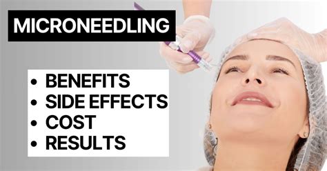 Microneedling Before And After A Beginner S Guide To The Benefits Of