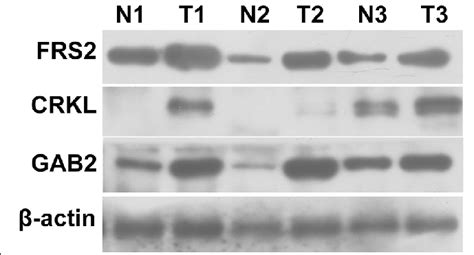 Western Blot Analyses Of Gab Crkl And Frs Expression In Pdac And