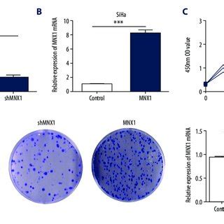 Overexpression Of Mnx Promoted Cervical Cancer Cell Lines