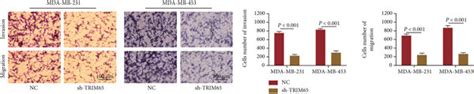 TRIM65 Promotes The Malignant Biological Behavior In Vitro A B The