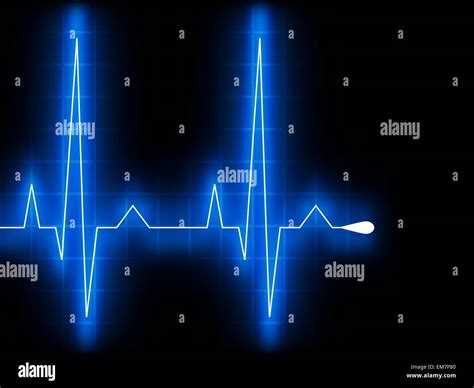 Prueba de esfuerzo electrocardiograma Imágenes vectoriales de stock Alamy