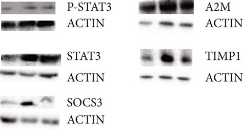 HXJD Reduces The Protein Expression Of P STAT3 STAT3 SOCS3 A2M And