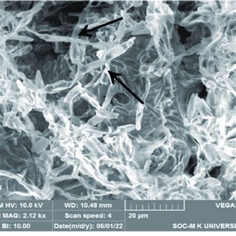 A Scanning Electron Micrographs SEM Of Fusarium Oxysporum F Sp