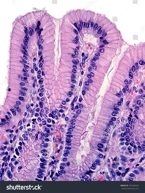 664 Simple Columnar Epithelium Images, Stock Photos, 3D objects ...