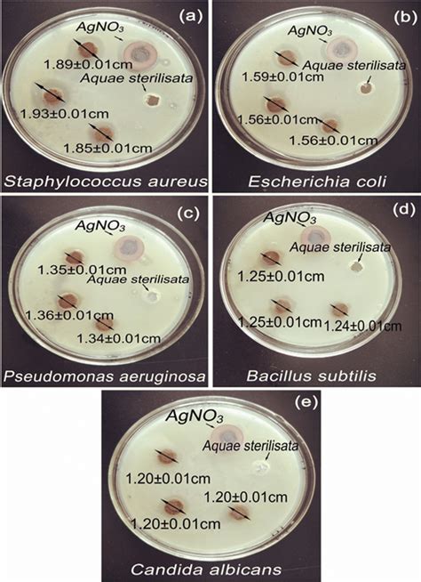 Inhibition Zone Diameters Of Four Common Bacteria And One Common Fungi