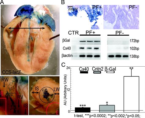 Contactin Expression In The Cardiac Purkinje Fiber Network