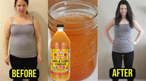 Free 62 Benefits Of Apple Cider Vinegar With Mother 2020 Nogii