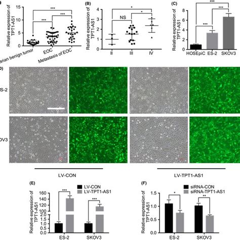 Expression Of Tpt1‐as1 In Epithelial Ovarian Cancer Eoc Tissue