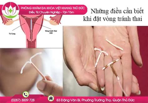 Những điều cần biết khi đặt vòng tránh thai