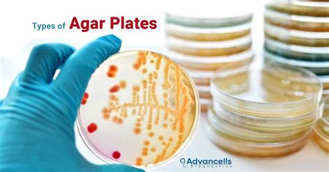 How To Dry Agar Plates Quickly At Anthony Crouse Blog