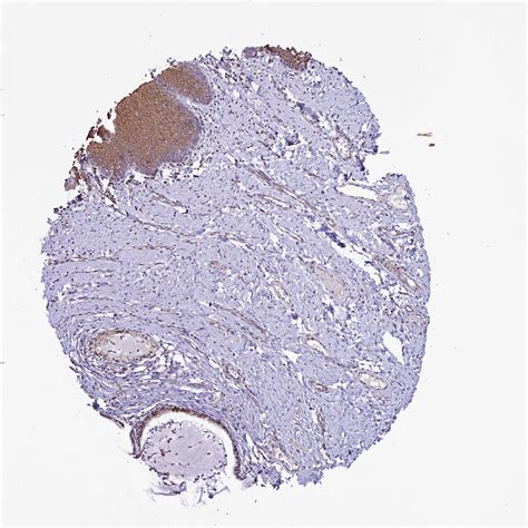 Tissue Expression Of Idh3a Staining In Cervix The Human Protein Atlas